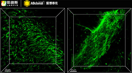 GFAP Rabbit mAb