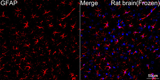 GFAP Rabbit mAb