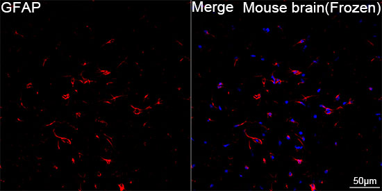 GFAP Rabbit mAb