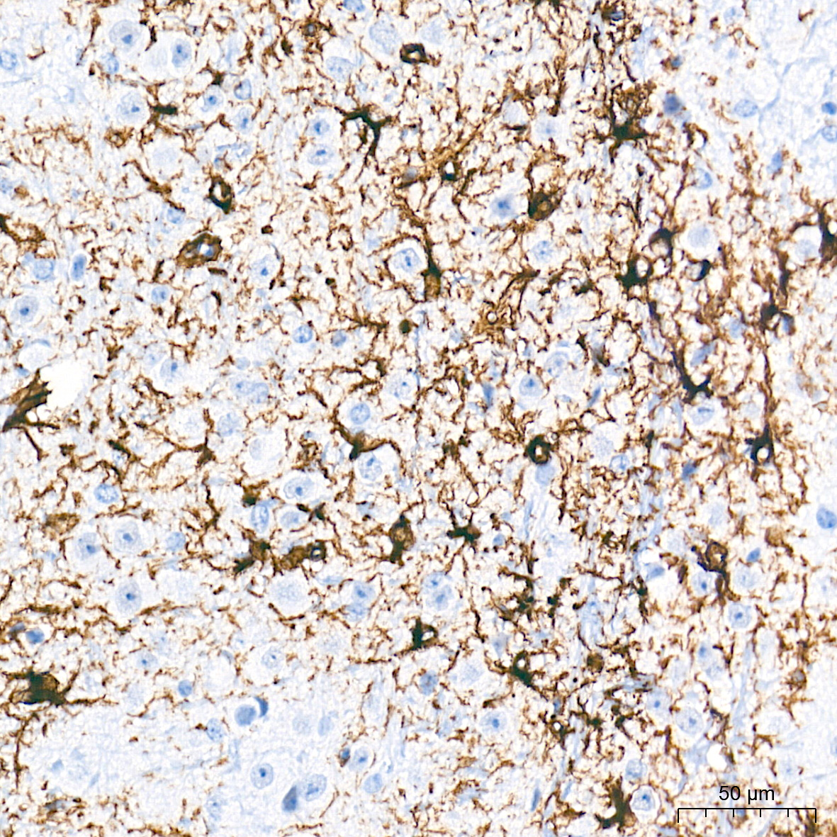 GFAP Rabbit mAb