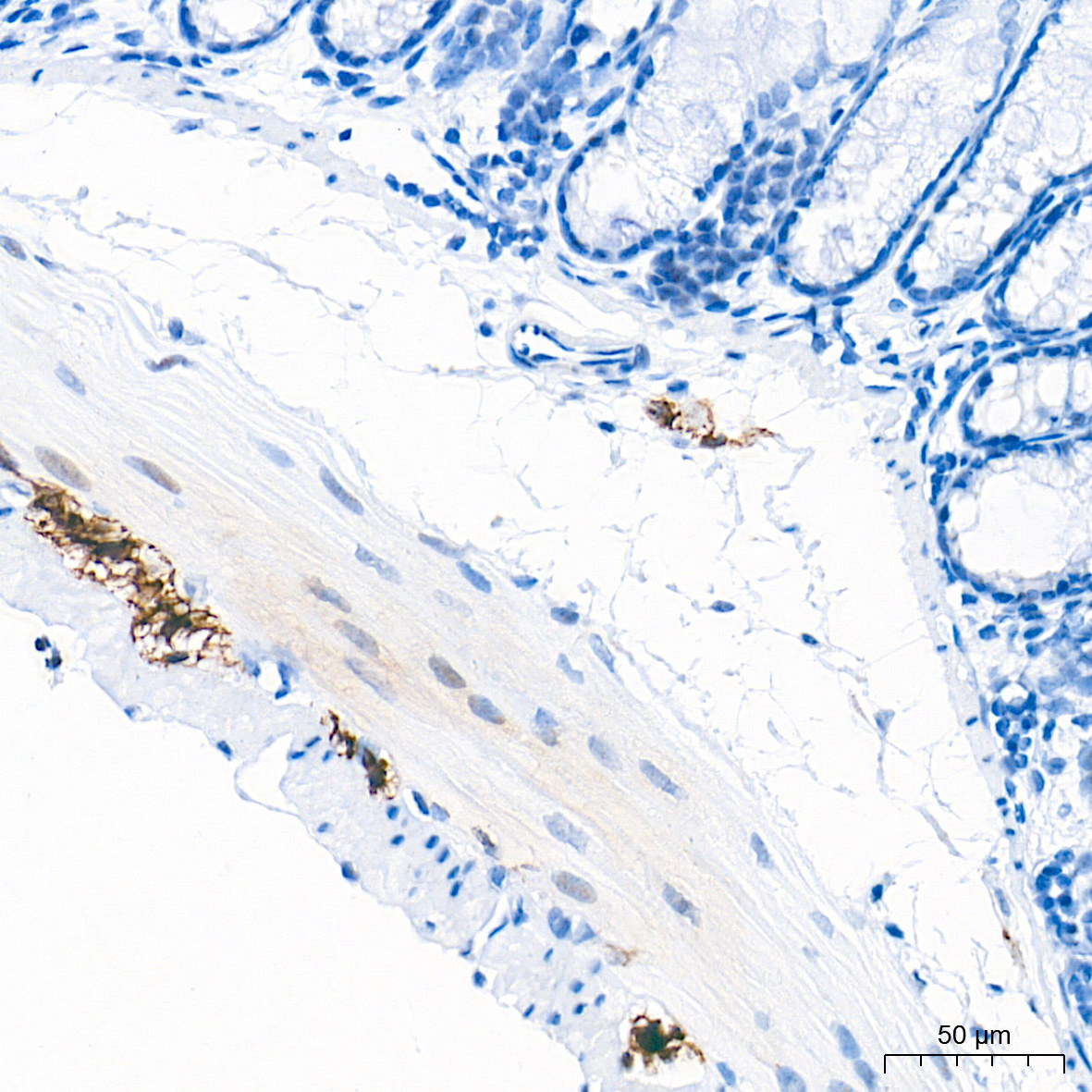 GFAP Rabbit mAb