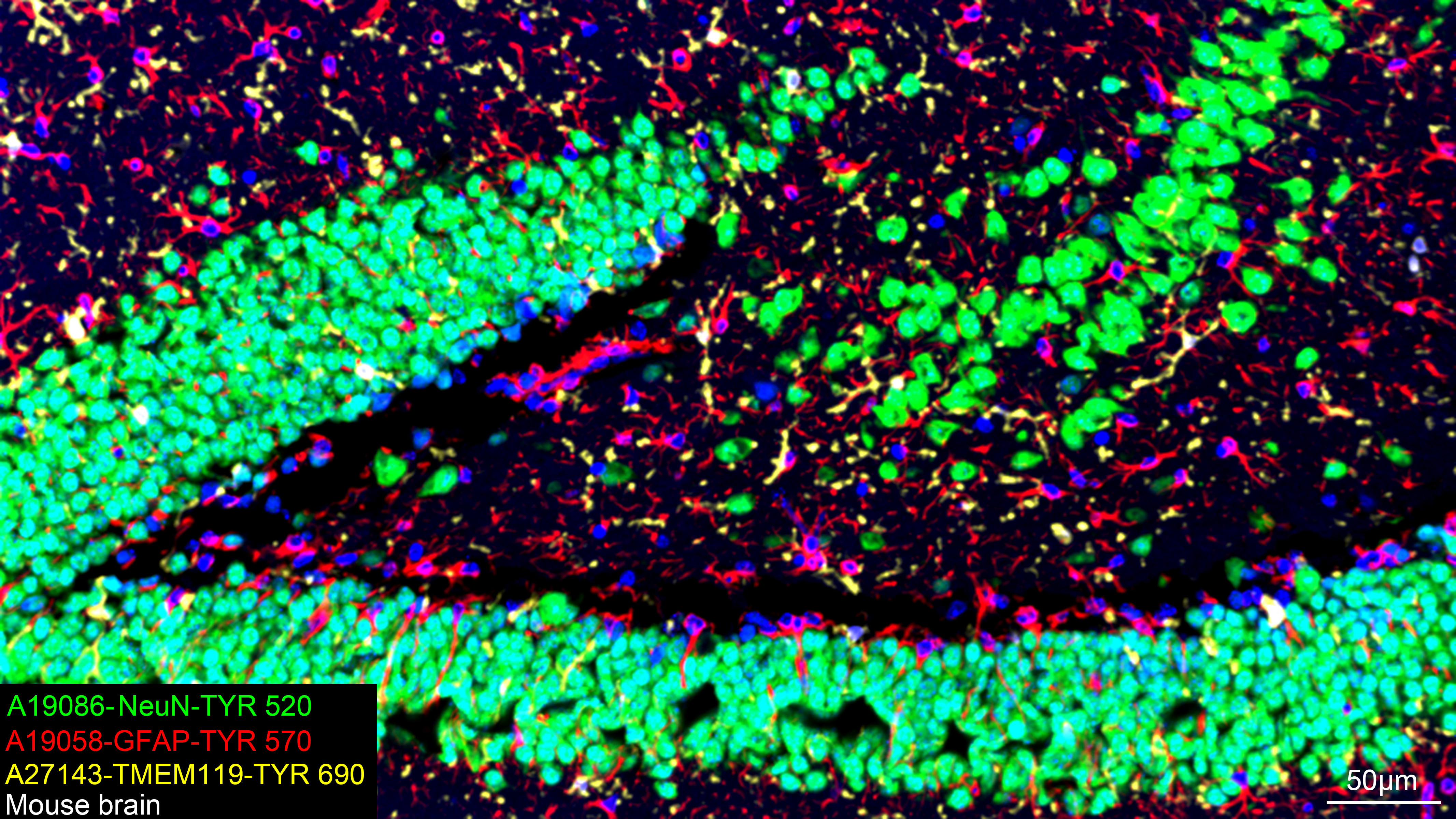 GFAP Rabbit mAb