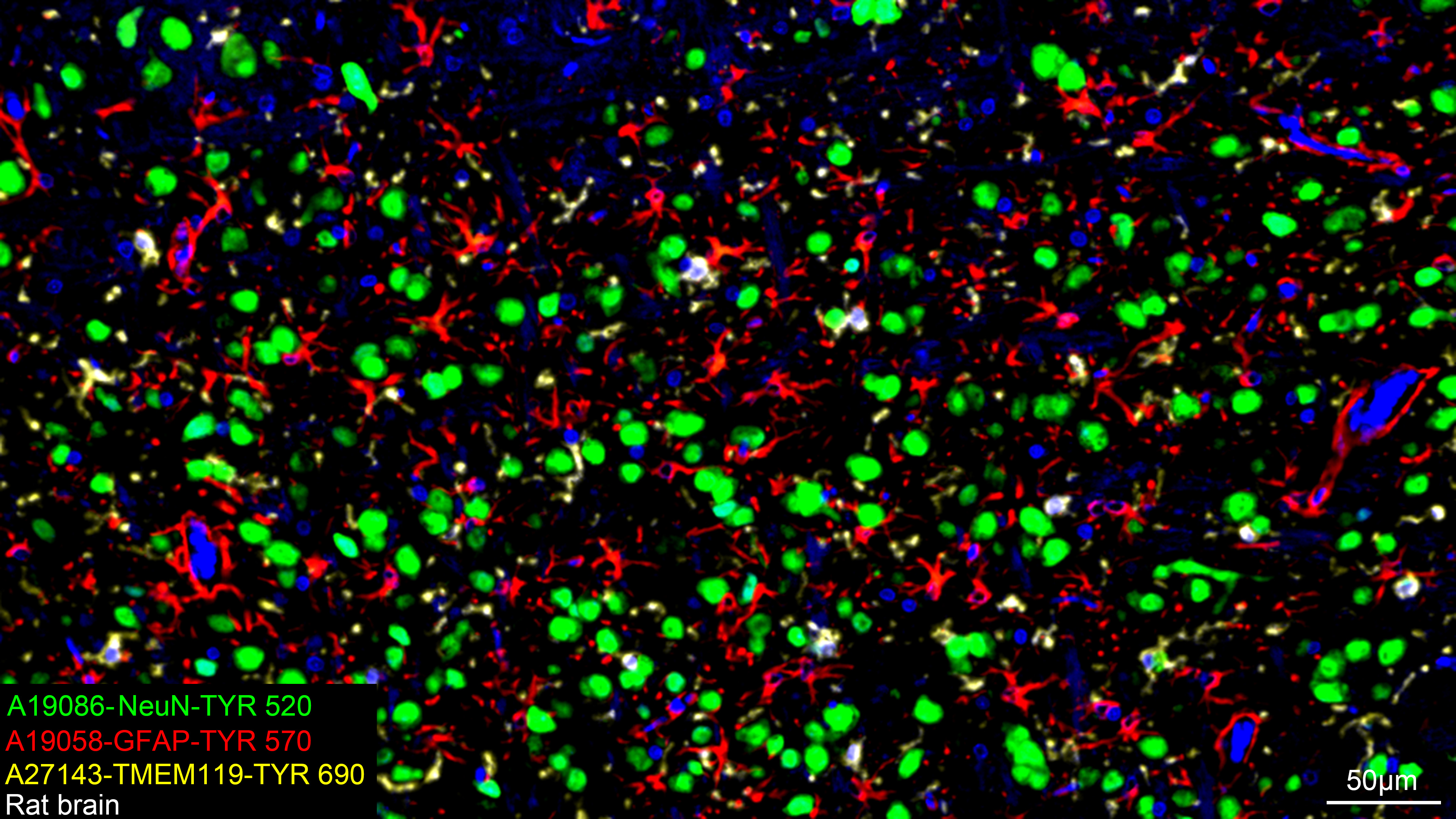 GFAP Rabbit mAb