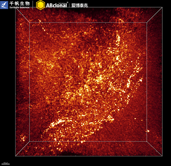 GFAP Rabbit mAb