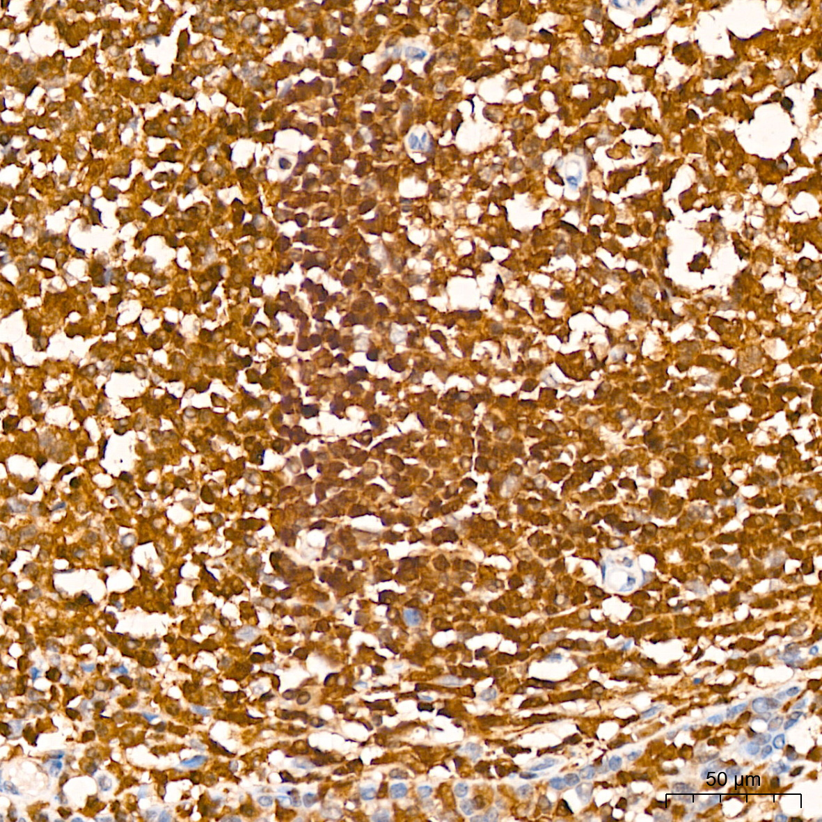 GRB2 Rabbit mAb