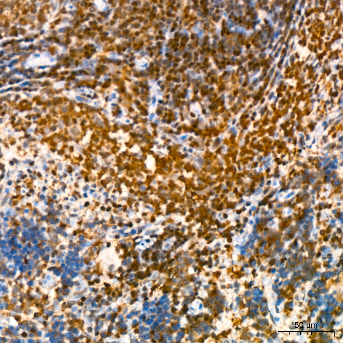 GRB2 Rabbit mAb