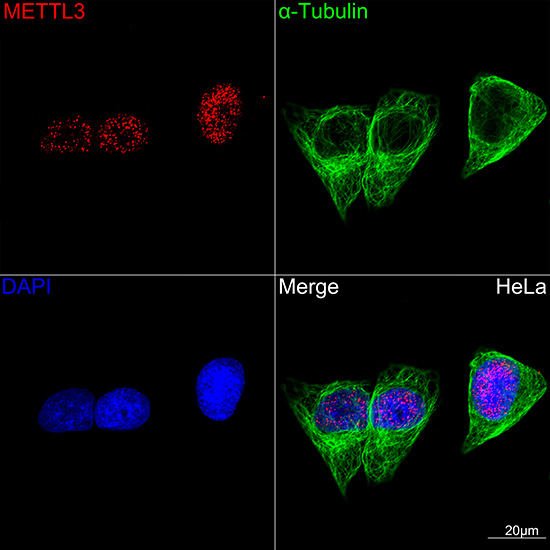 [KD Validated] METTL3 Rabbit mAb