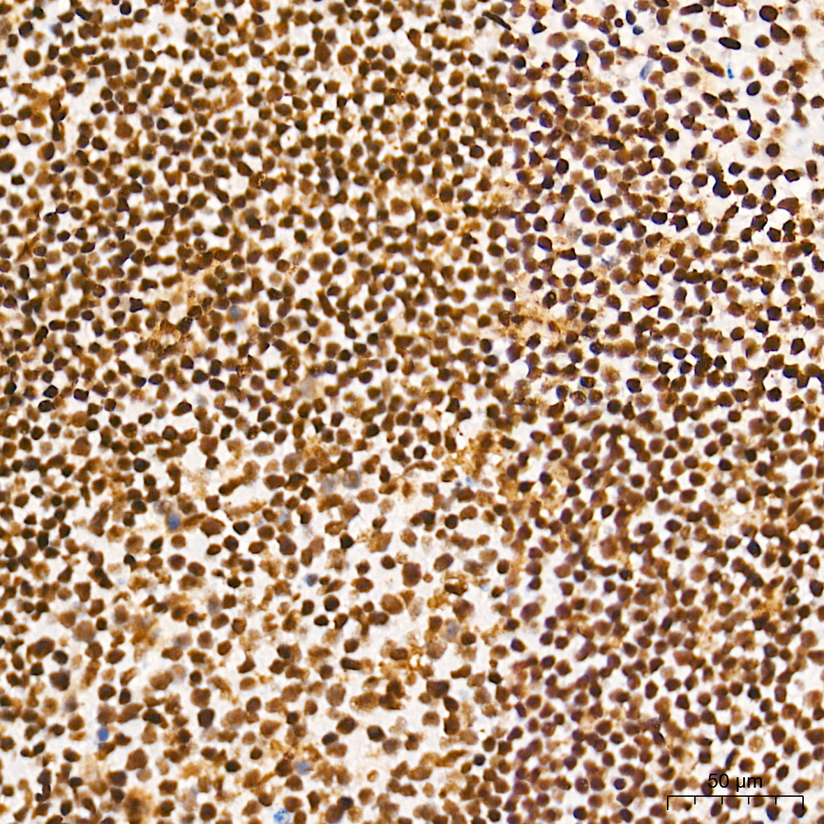 METTL3 Rabbit mAb