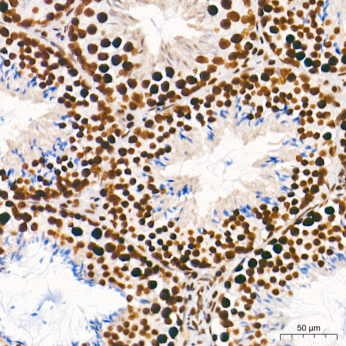 [KD Validated] METTL3 Rabbit mAb