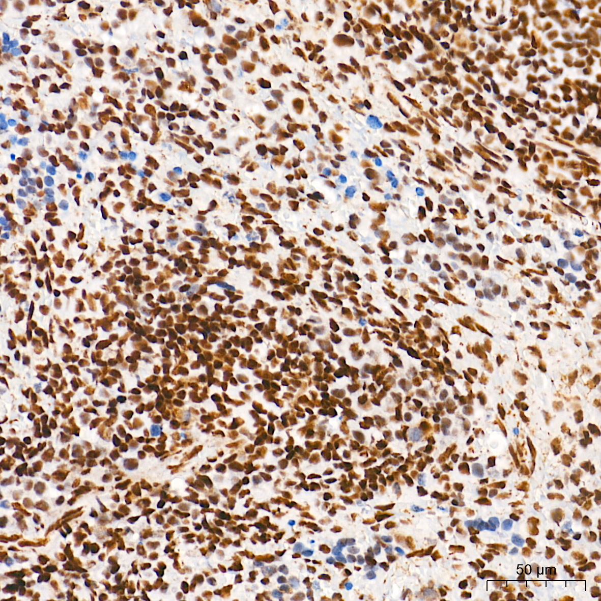 METTL3 Rabbit mAb