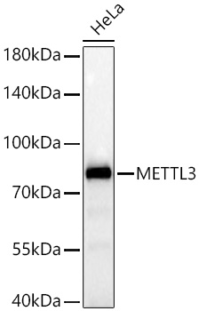 [KD Validated] METTL3 Rabbit mAb