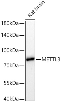 [KD Validated] METTL3 Rabbit mAb