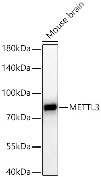 [KD Validated] METTL3 Rabbit mAb