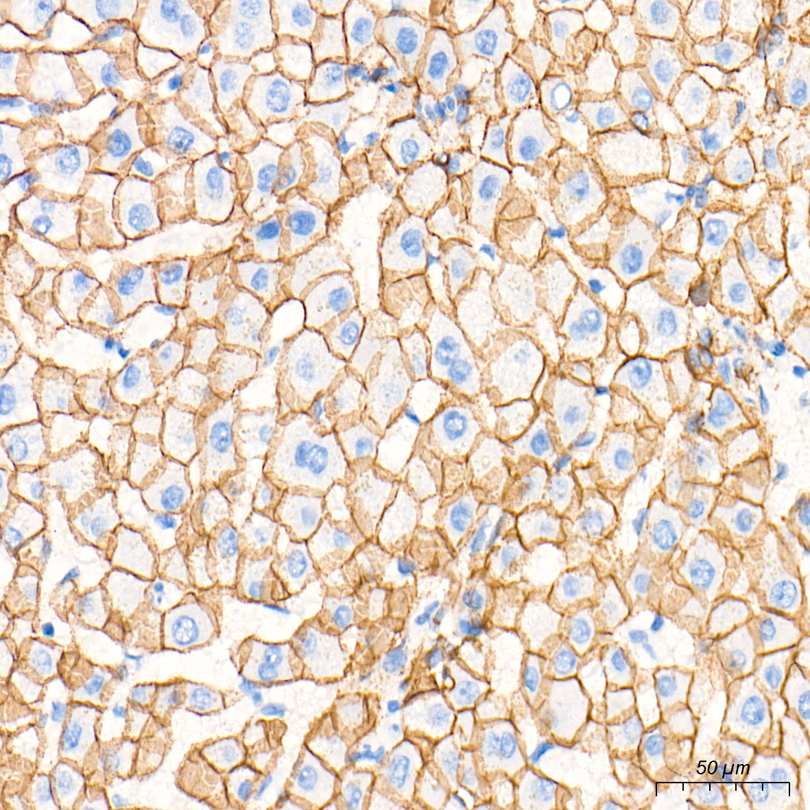 [KO Validated] N-Cadherin Rabbit mAb
