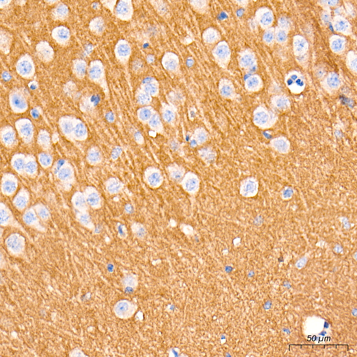 [KO Validated] N-Cadherin Rabbit mAb