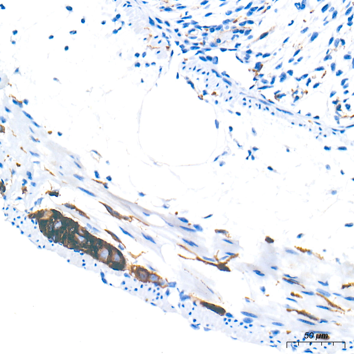 [KO Validated] N-Cadherin Rabbit mAb