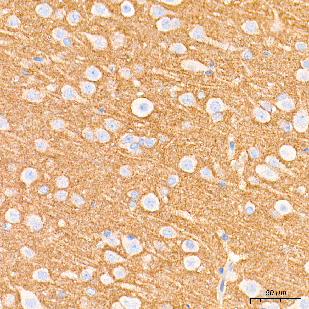 [KO Validated] N-Cadherin Rabbit mAb