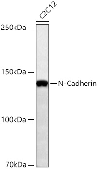 [KO Validated] N-Cadherin Rabbit mAb