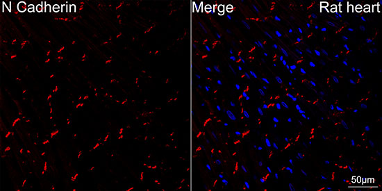 [KO Validated] N-Cadherin Rabbit mAb
