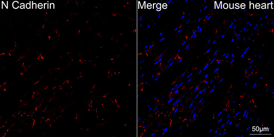 [KO Validated] N-Cadherin Rabbit mAb
