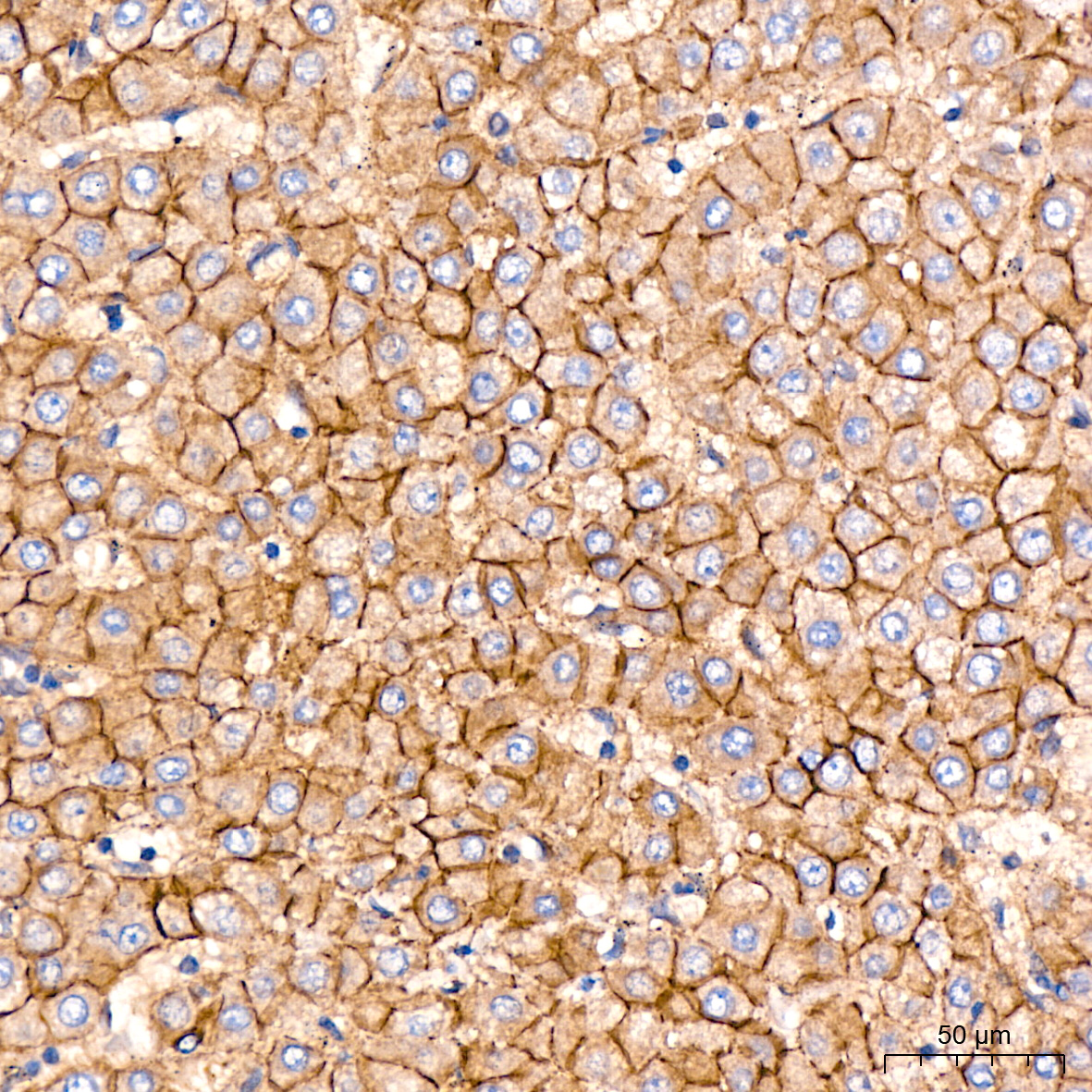 [KO Validated] N-Cadherin Rabbit mAb