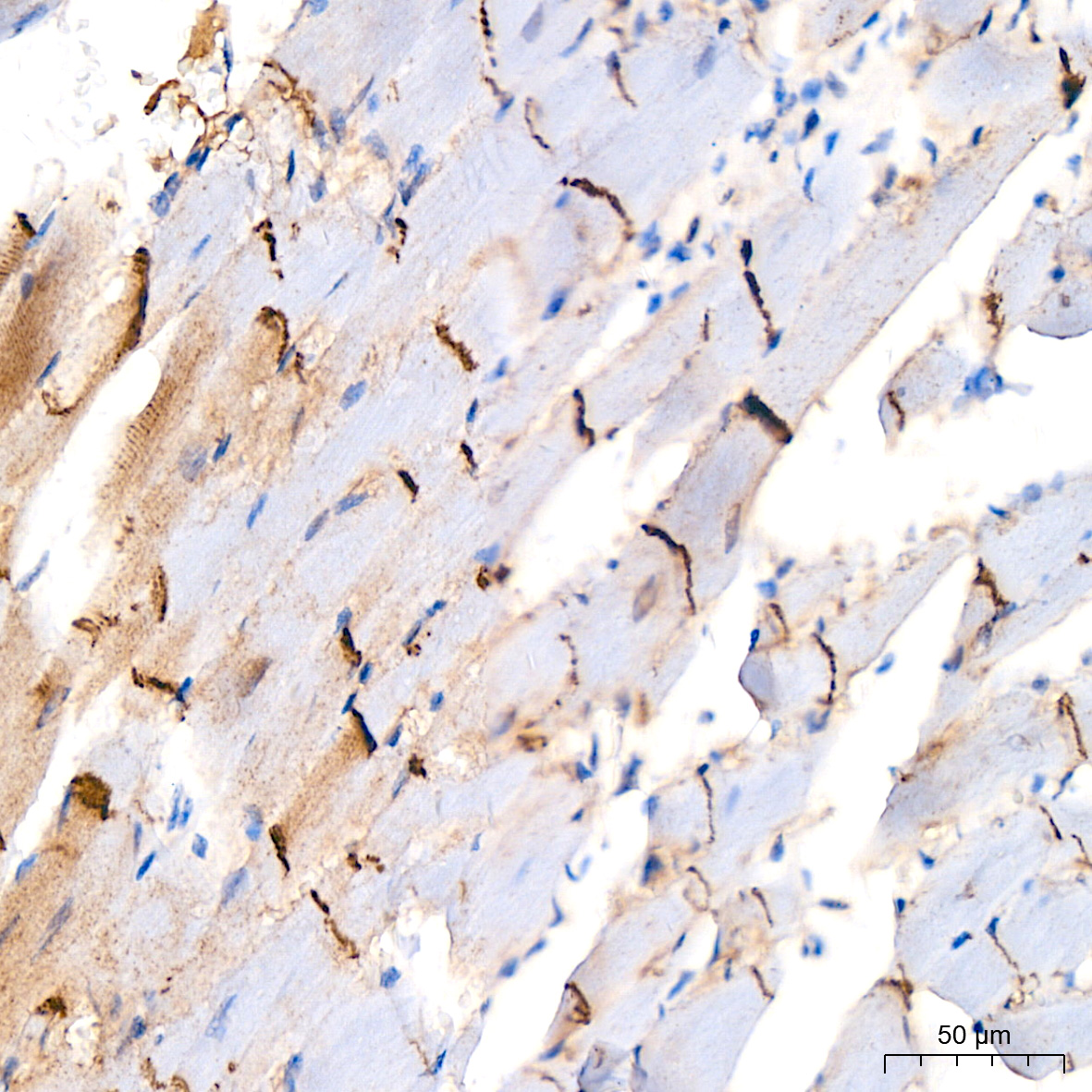 [KO Validated] N-Cadherin Rabbit mAb