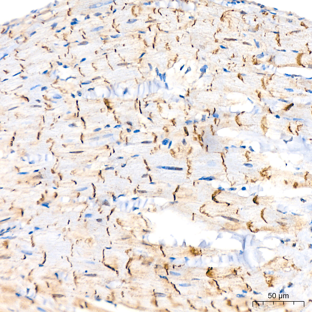 [KO Validated] N-Cadherin Rabbit mAb