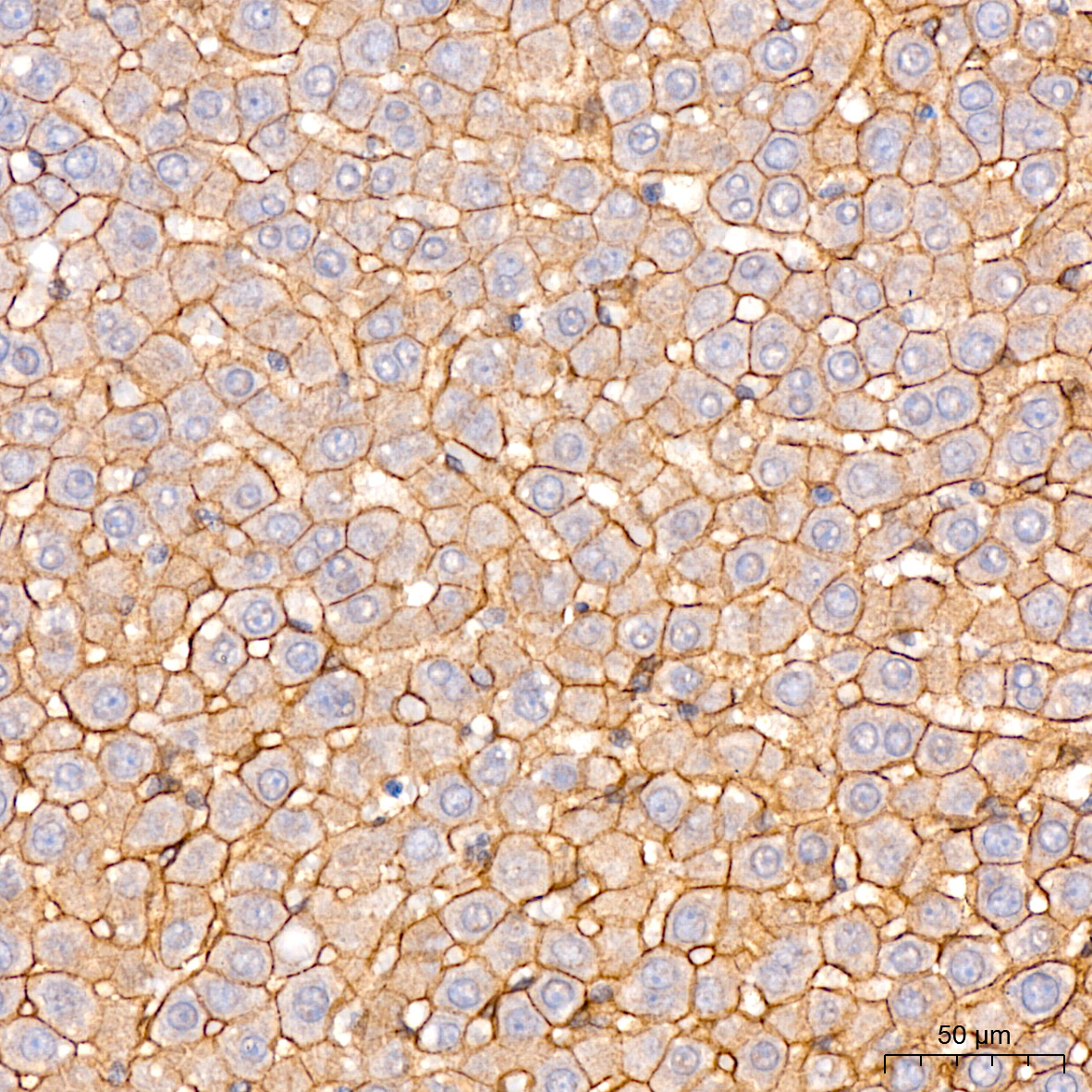 [KO Validated] N-Cadherin Rabbit mAb