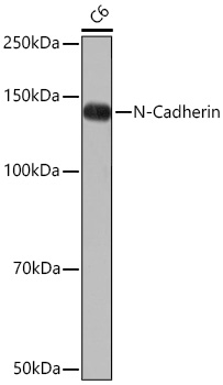 [KO Validated] N-Cadherin Rabbit mAb
