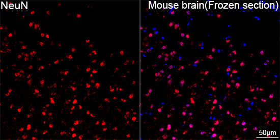 NeuN Rabbit mAb