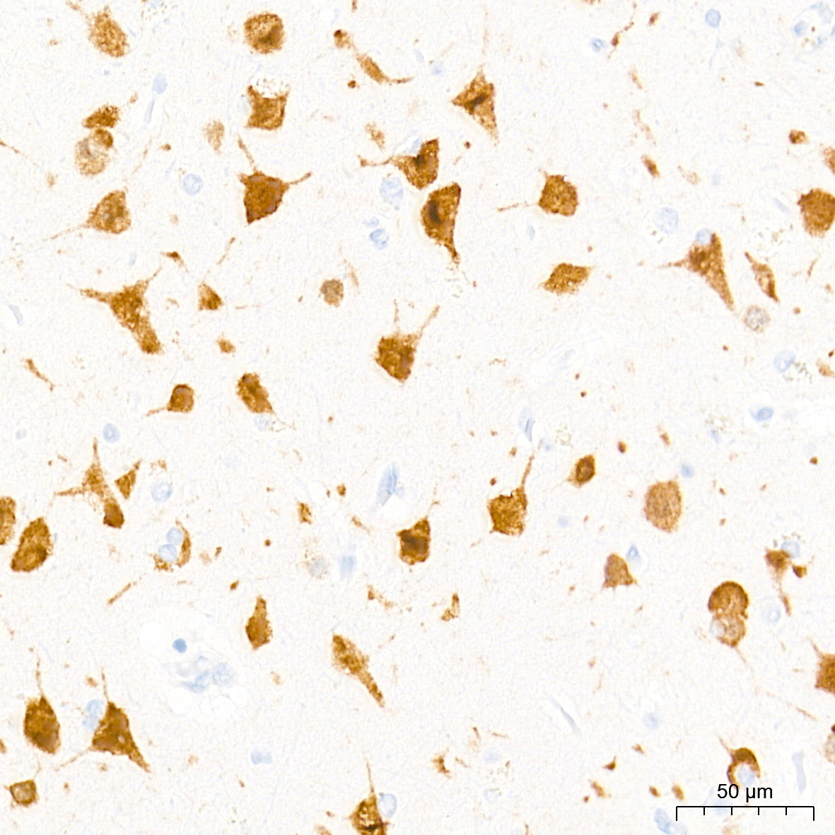 NeuN Rabbit mAb