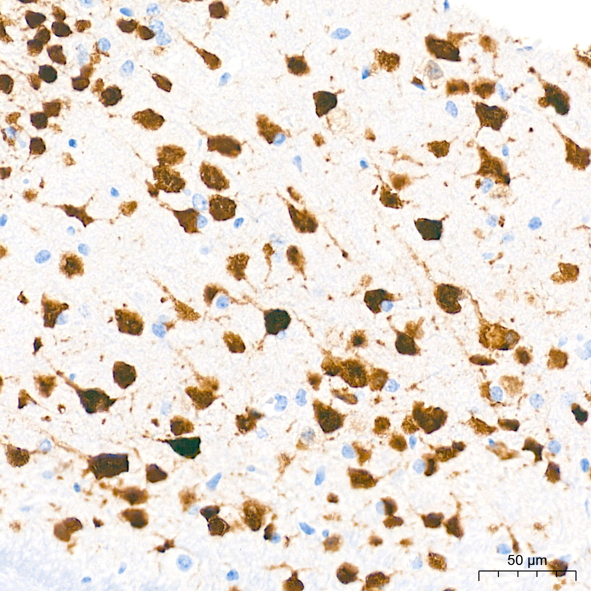 NeuN Rabbit mAb