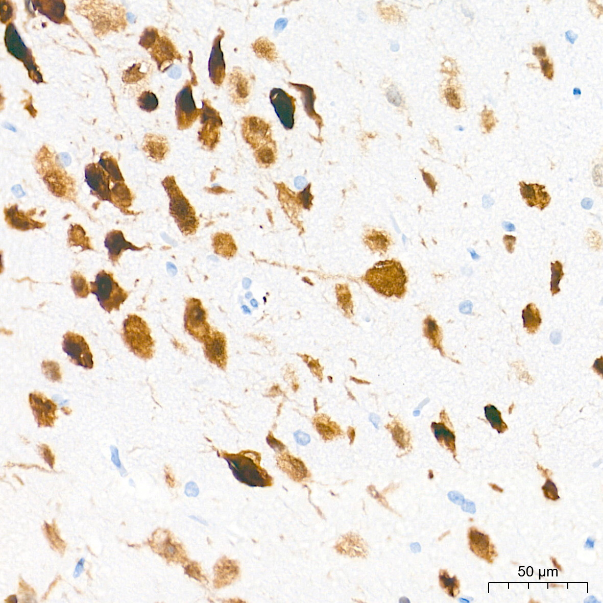 NeuN Rabbit mAb
