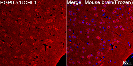 PGP9.5/UCHL1 Rabbit mAb