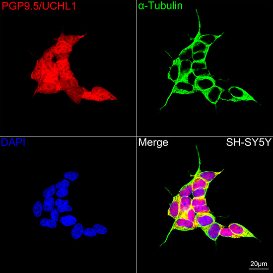 PGP9.5/UCHL1 Rabbit mAb