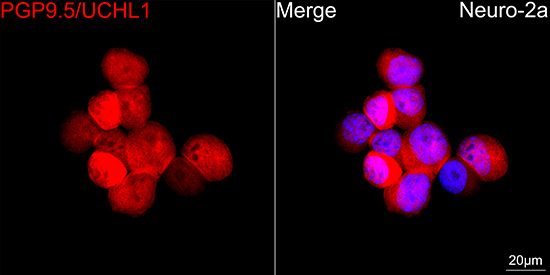 PGP9.5/UCHL1 Rabbit mAb