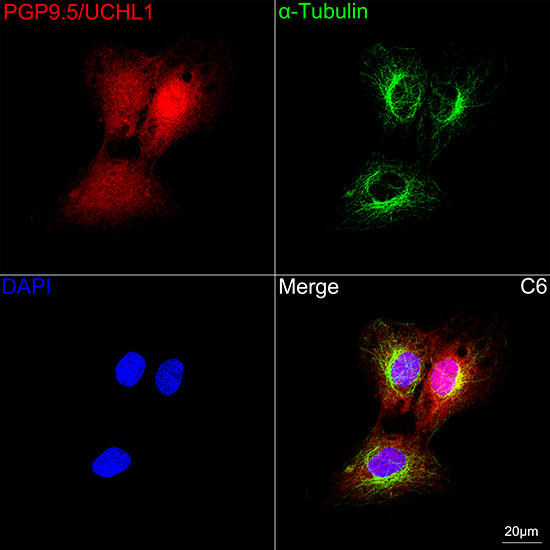 PGP9.5/UCHL1 Rabbit mAb