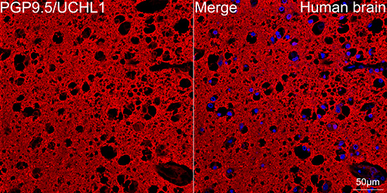 PGP9.5/UCHL1 Rabbit mAb