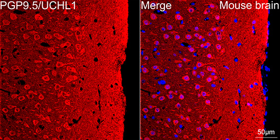 PGP9.5/UCHL1 Rabbit mAb