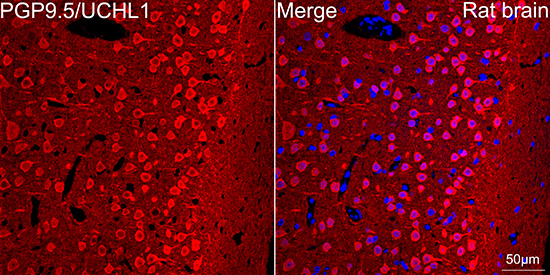 PGP9.5/UCHL1 Rabbit mAb