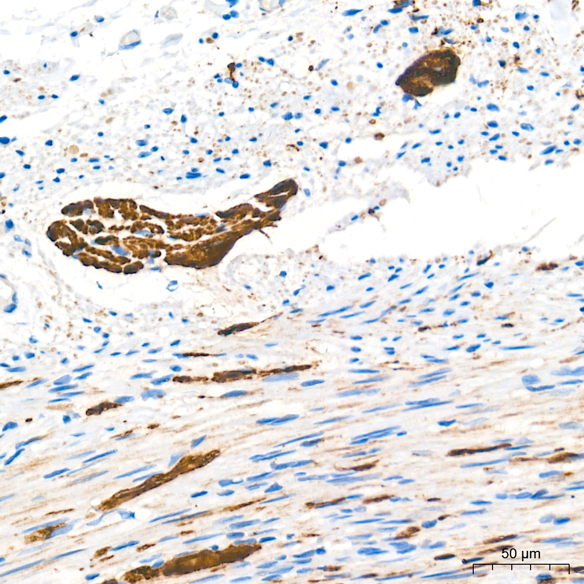 PGP9.5/UCHL1 Rabbit mAb