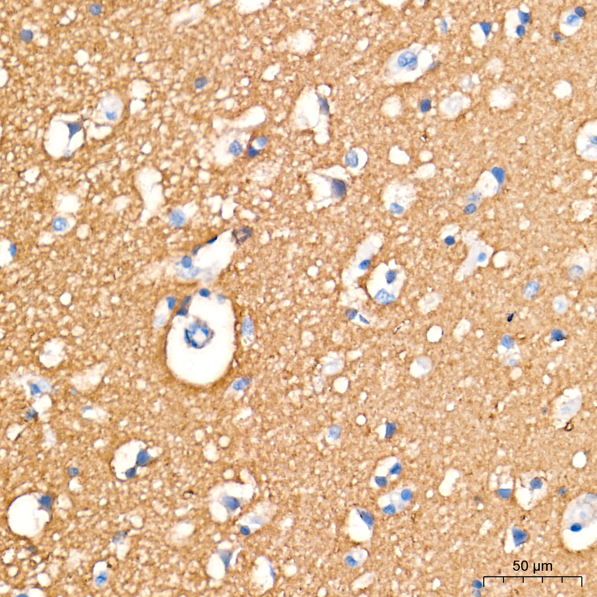 PGP9.5/UCHL1 Rabbit mAb