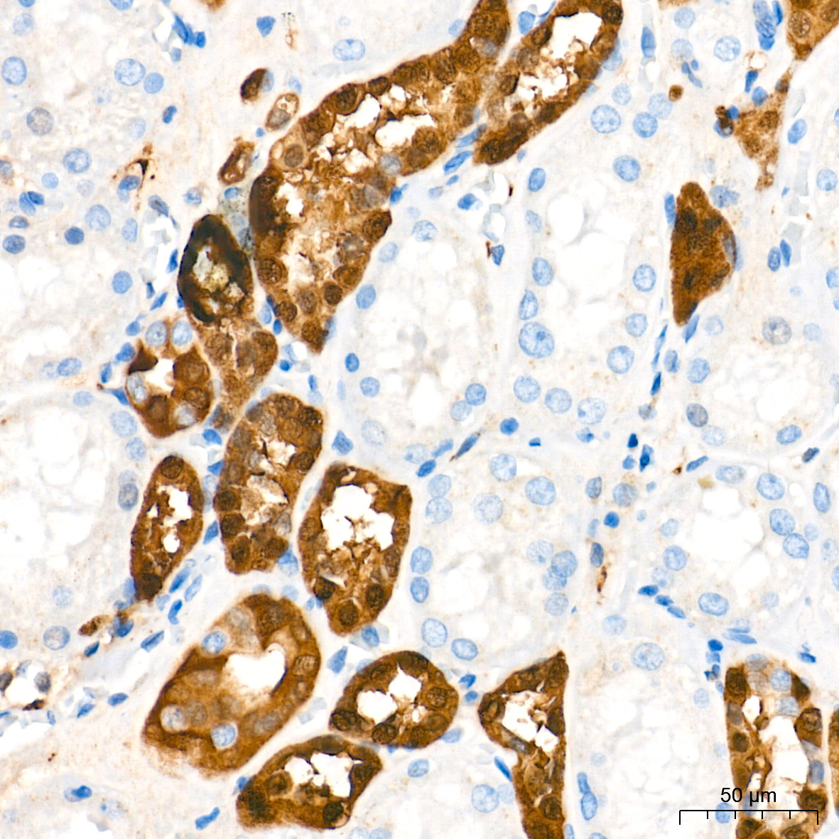 PGP9.5/UCHL1 Rabbit mAb