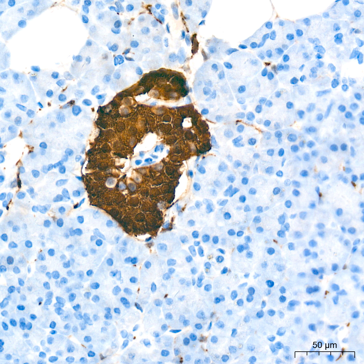 PGP9.5/UCHL1 Rabbit mAb