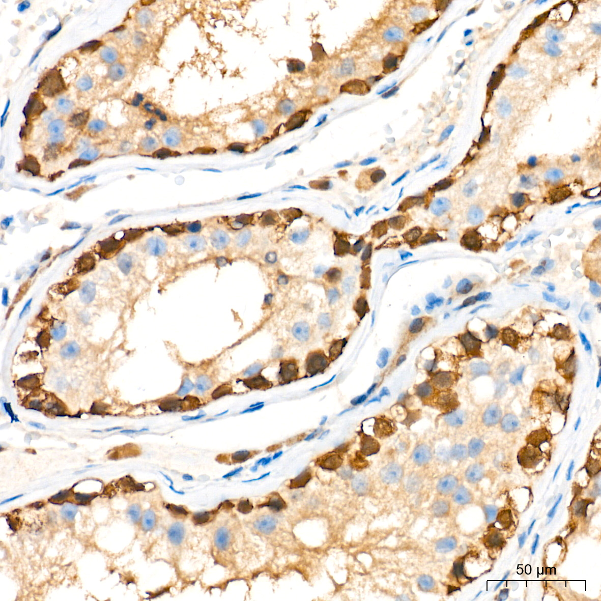 PGP9.5/UCHL1 Rabbit mAb