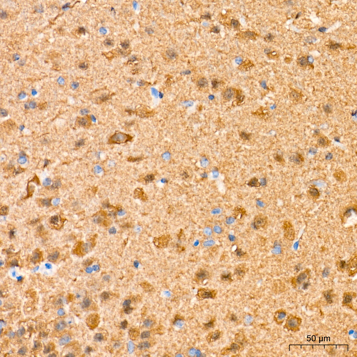 PGP9.5/UCHL1 Rabbit mAb
