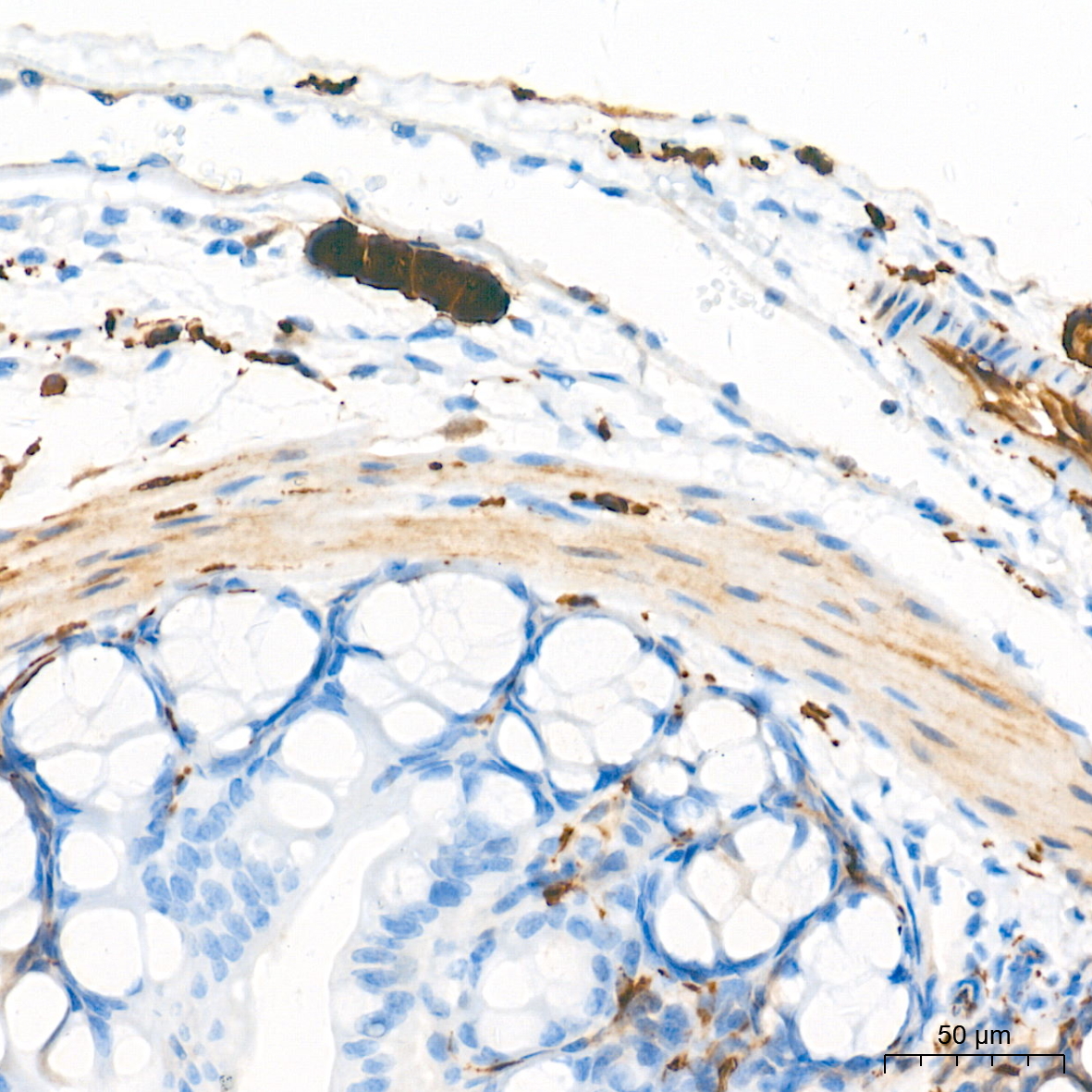 PGP9.5/UCHL1 Rabbit mAb