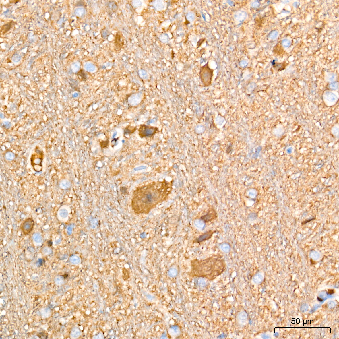 PGP9.5/UCHL1 Rabbit mAb