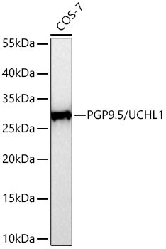 PGP9.5/UCHL1 Rabbit mAb