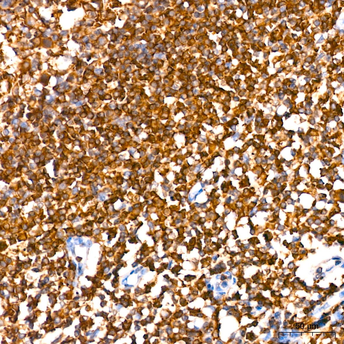 SHP1 Rabbit mAb